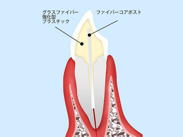 セラミック治療は保険診療と何が違うの・・・？