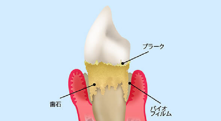 身近でおそろしい病気です